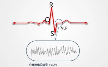 心电图室工作总结8篇